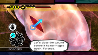 Illustration for article titled Clear The Way For New Trauma Team Screens